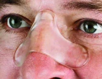 Gecko™ Nasal Pad - Image 2